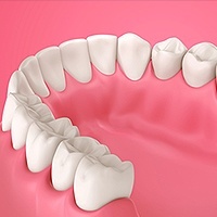 Gum Disease Santa Clara, CA